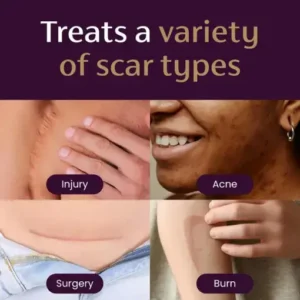 BQYOOM™ Advanced Scar Gel