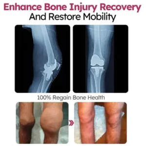 BQYOOM™ Joint and Bone Recovery Cream