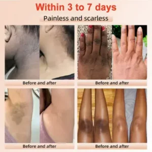 BQYOOM™ Purifying Exfoliating Gel