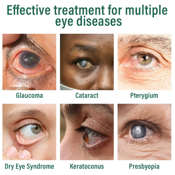 BQYOOM™ Nano Eye Drops Serum - Image 3